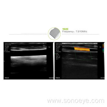 wireless wifi ultrasound 192E Linear